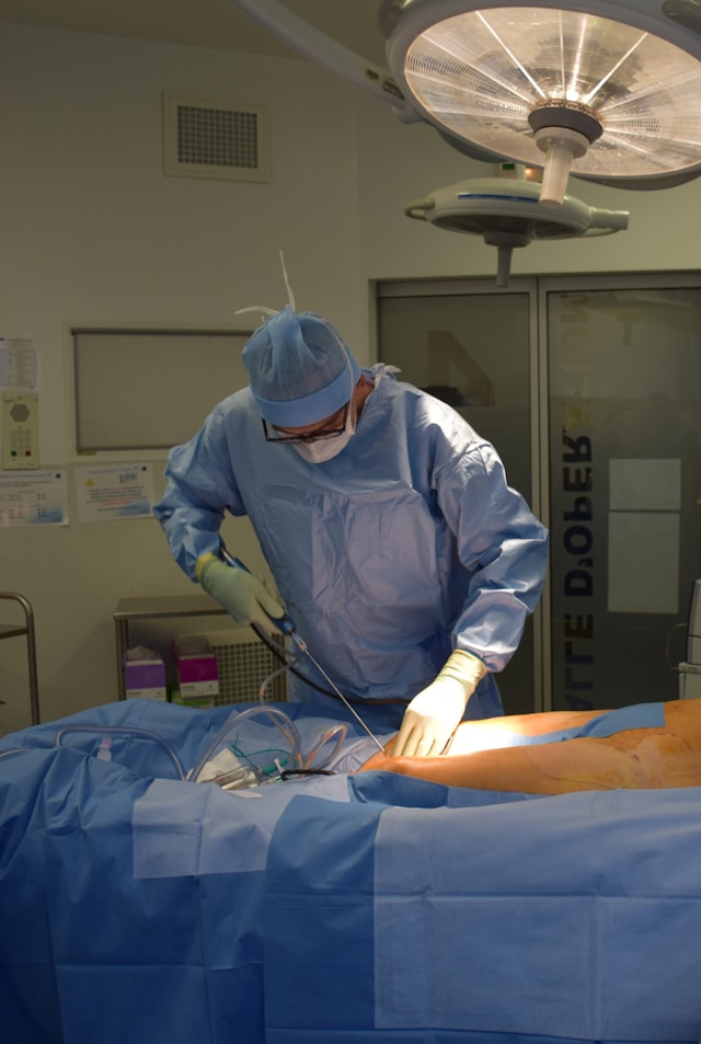 Liposuction